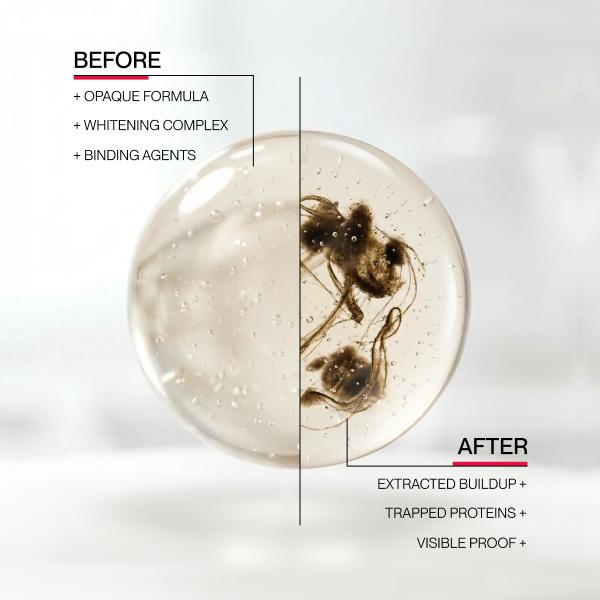 Gunk Removing Mouthwash - Remove Bad Breath And Whiten Teeth