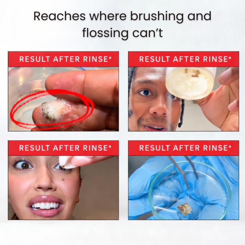 Gunk Removing Mouthwash - Remove Bad Breath And Whiten Teeth