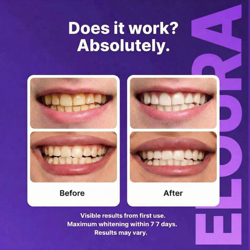 Eloura Purple Teeth Whitening Strips