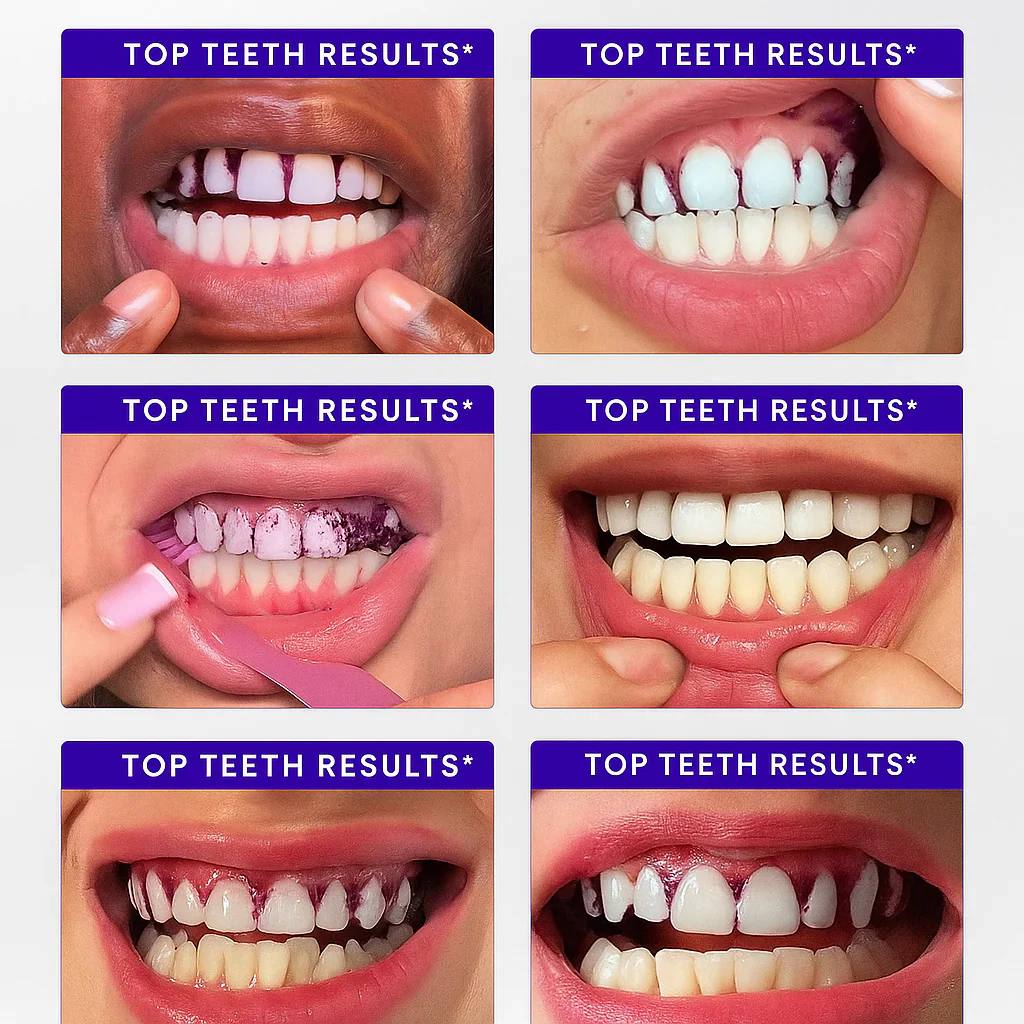 Eloura Purple Teeth Whitening Strips