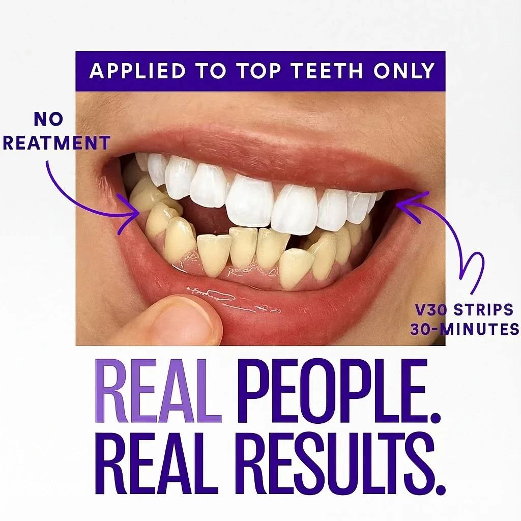 Eloura Purple Teeth Whitening Strips